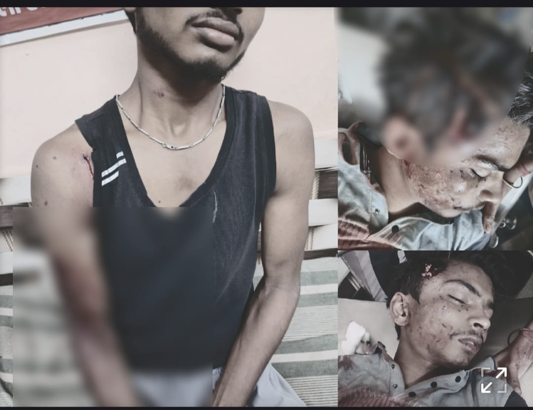 सक्ती में सनसनीखेज वारदात: आधी रात घर में घुसे 3 नकाबपोश, सोते हुए दो भाइयों पर बरसाईं गोलियां; बड़े भाई की मौत सक्ती में सनसनीखेज वारदात: आधी रात घर में घुसे 3 नकाबपोश, सोते हुए दो भाइयों पर बरसाईं गोलियां; बड़े भाई की मौत