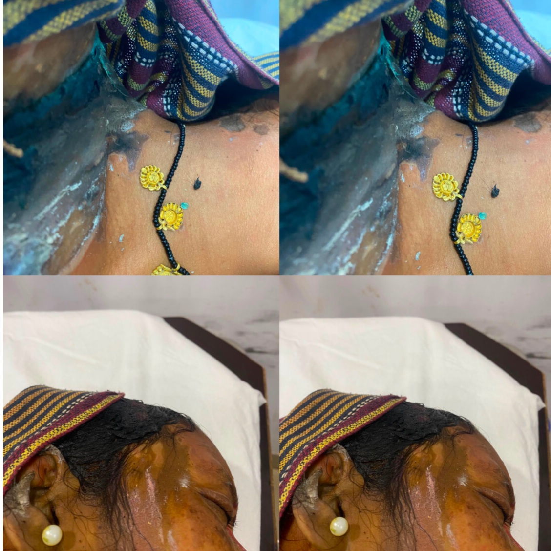 दुर्ग: कावड़ यात्रा के दौरान खौफनाक वारदात, बाइक सवार ने महिला पर फेंका तेजाब दुर्ग: कावड़ यात्रा के दौरान खौफनाक वारदात, बाइक सवार ने महिला पर फेंका तेजाब